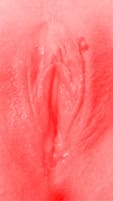 red vulva