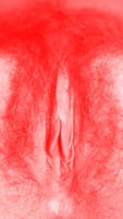 red vulva