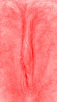 red vulva