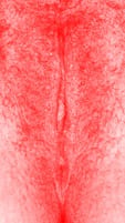 red vulva