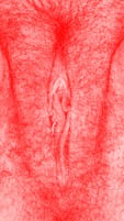red vulva