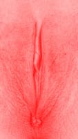 red vulva