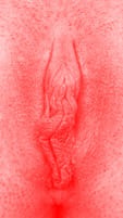 red vulva