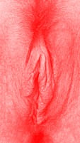 red vulva