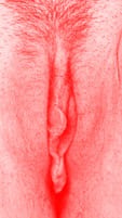 red vulva