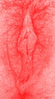 red vulva
