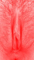 red vulva