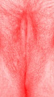 red vulva