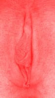 red vulva