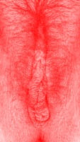 red vulva