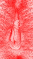 red vulva