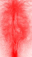 red vulva