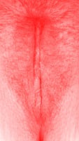 red vulva