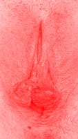 red vulva