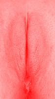 red vulva