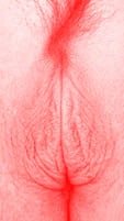red vulva