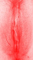 red vulva
