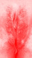red vulva