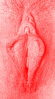 red vulva