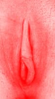 red vulva