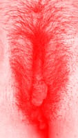 red vulva