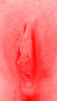 red vulva