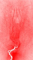red vulva