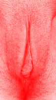 red vulva