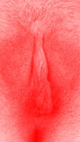 red vulva