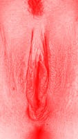 red vulva