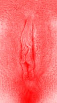 red vulva