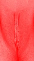 red vulva
