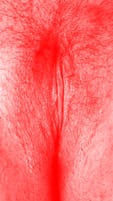 red vulva