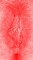 red vulva