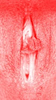 red vulva
