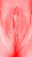 red vulva