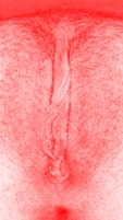 red vulva