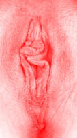 red vulva